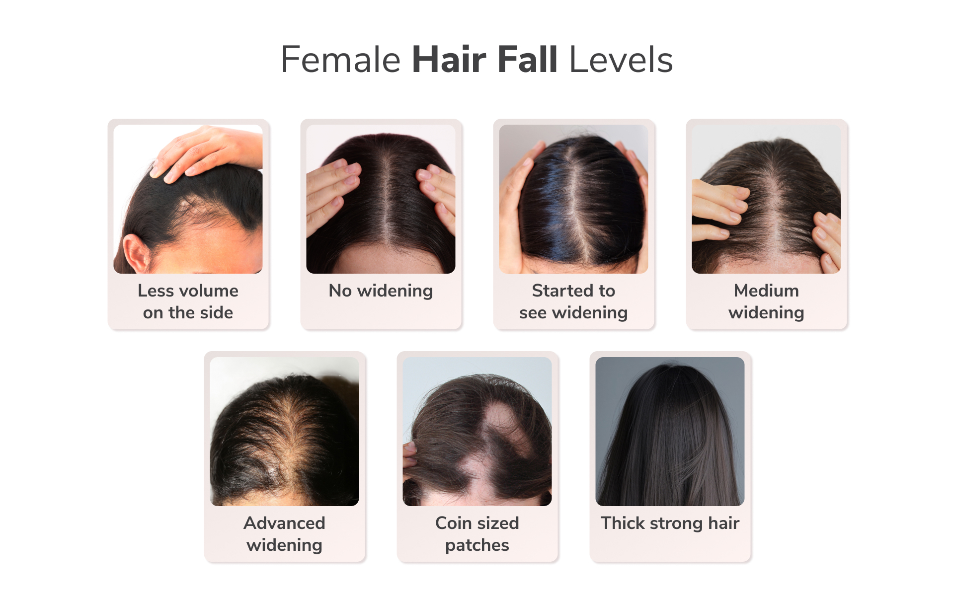 Traya’s Study Reveals a Concerning Finding: One in Two Women Aged 36-40 Suffer from Advanced Widening or Female Pattern Hair Loss